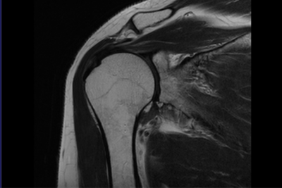 Плечевой сустав.png