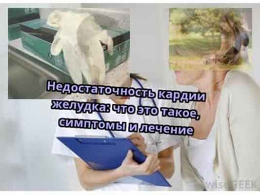 Недостаточность кардии желудка