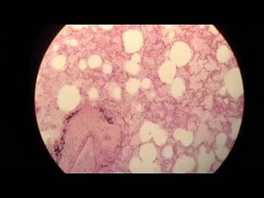 Пульмонология