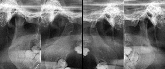 Зонограмма