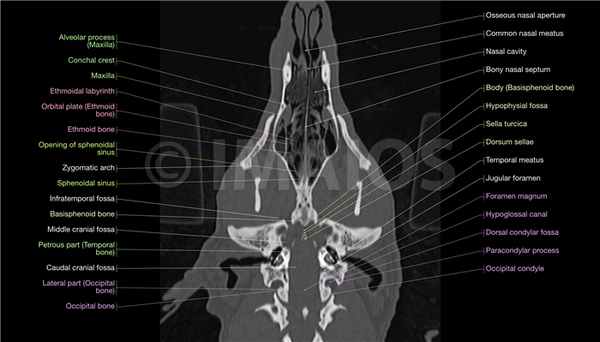 Анатомия в срезах - Голова - КТ