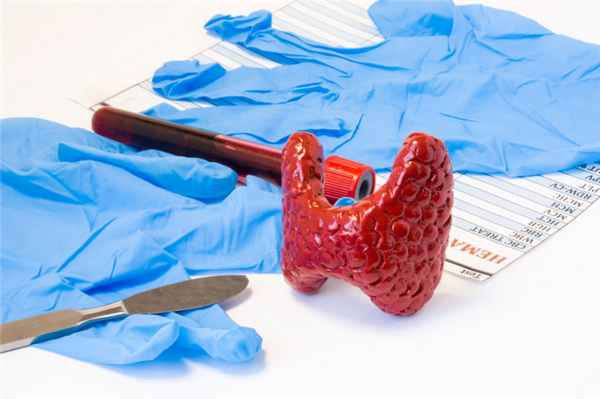 Гиперпаратиреоз