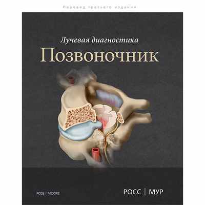 Лучевая диагностика. Позвоночник - Росс Дж. С., Мур К. Р.