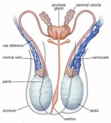 Лечение варикоцеле