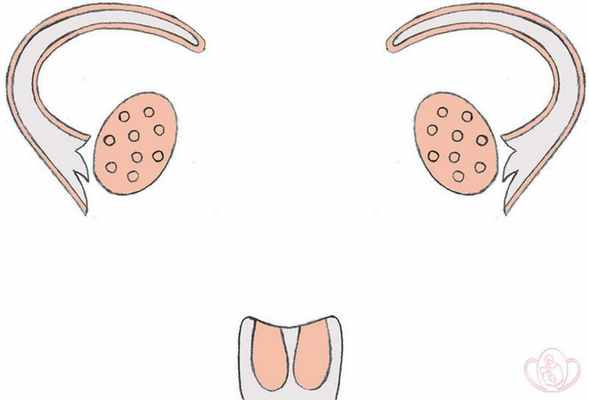 Частичная агенезия (отсутствие) или гипоплазия (недоразвитие) мюллеровых протоков. Шеечная