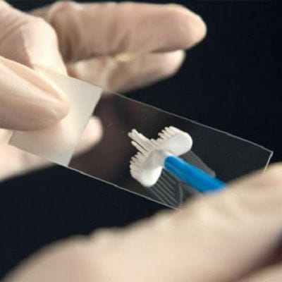 Бартолинит