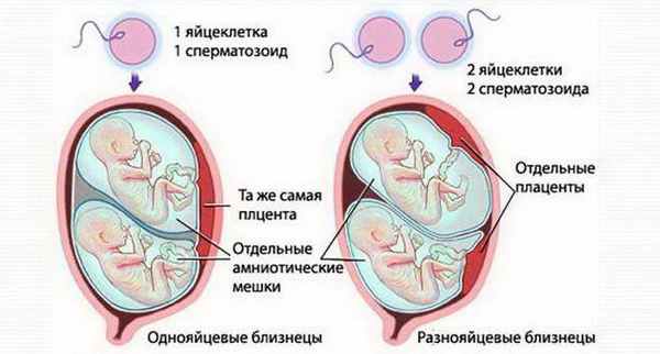 Виды двойни