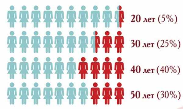endometrioz matki 02