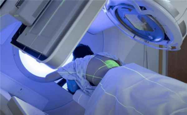 Пациент с фибросаркомой проходит сеанс лучевой терапии