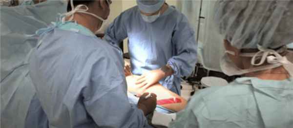 Команда врачей проводит операцию пациенту с фибросаркомой