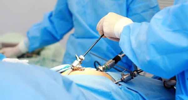 Киста яичника