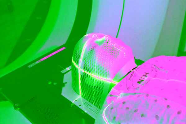 Лучевая терапия при меланоме