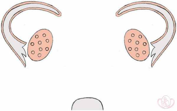 Частичная агенезия (отсутствие) или гипоплазия (недоразвитие) мюллеровых протоков. Влагалищная
