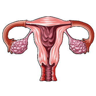 Поликистоз яичников