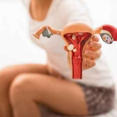 Киста яичника