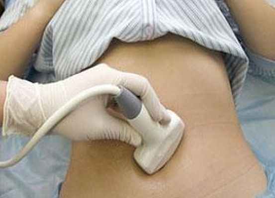 диагностика опухолей яичников