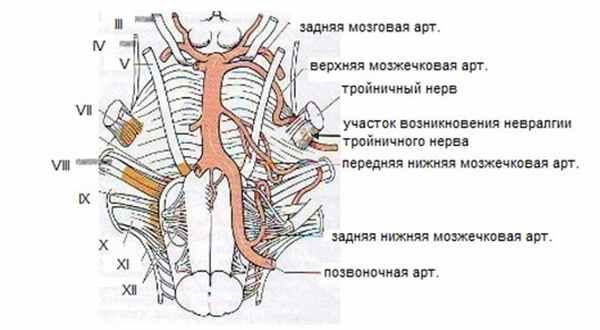  МРТ при нейроваскулярном конфликте