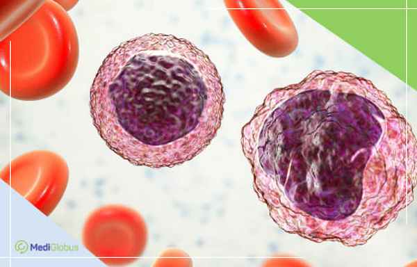 макроглобулинемия вальденстрема это