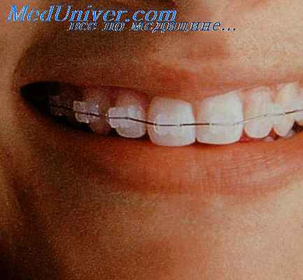 мастикациография