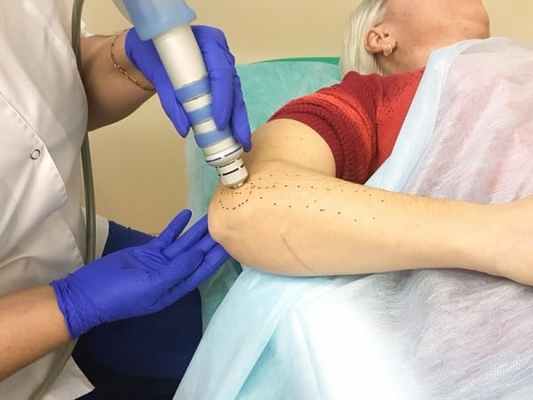 Эпикондилит