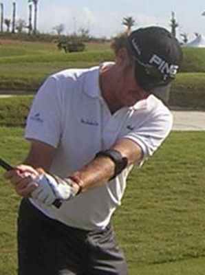 Эпикондилит