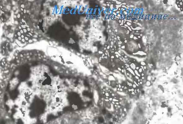 строение меланоцитов