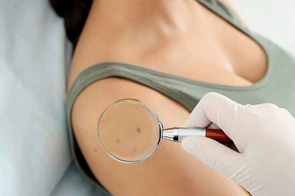 Контагиозный моллюск: как выглядит