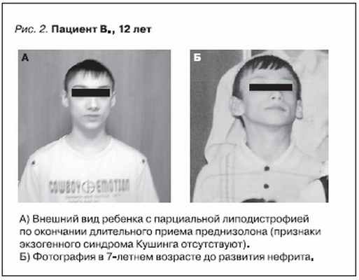 Пациент В., 12 лет