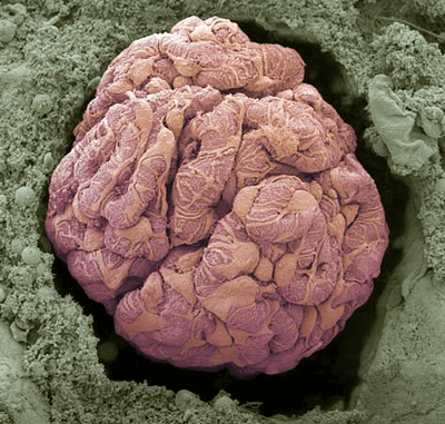 Почечный клубочек