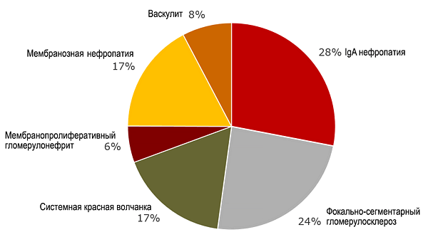 Причины гломерулонефрита