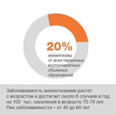 менингиомы_1_.jpg