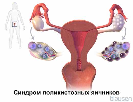 Бурлакова Елена Владимировна