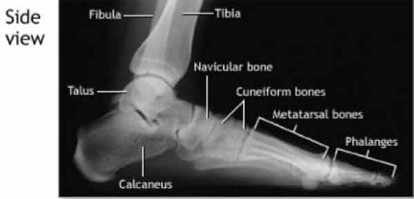 Рентген стопы - Фото Викимедиа