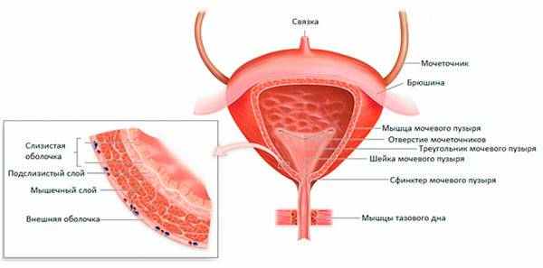 Рак мочевого пузыря 