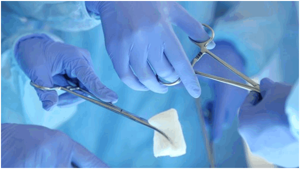 Гемиколэктомия