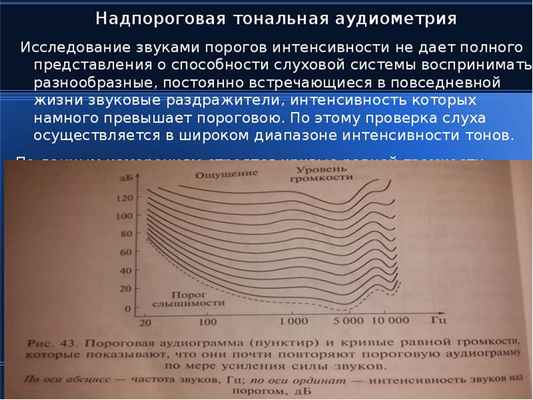 Надпороговая тональная аудиометрия Надпороговая тональная аудиометрия Исследование звуками порогов и