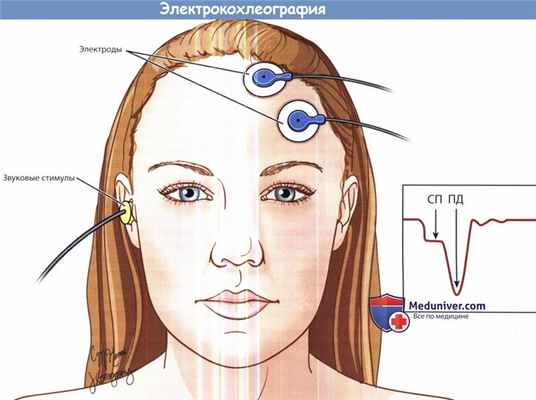 Электрокохлеография
