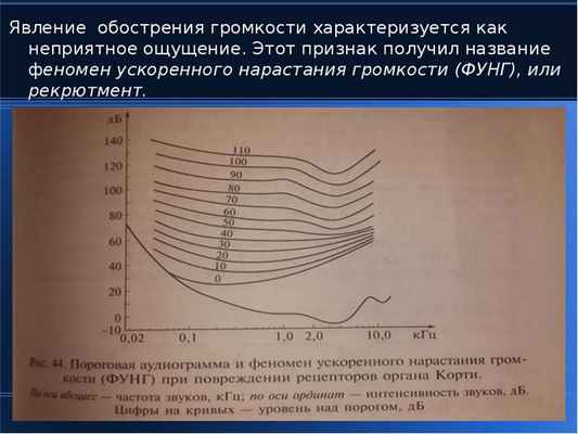 Явление обострения громкости характеризуется как неприятное ощущение. Этот признак получил название