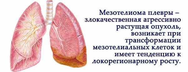 мезотелиома плевры
