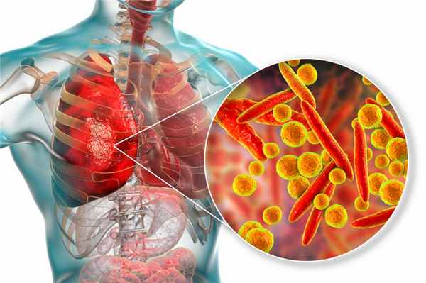 Респираторный микоплазмоз.jpg