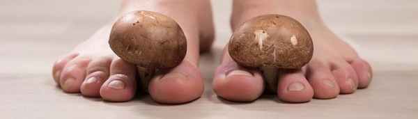 Микозы кожи: «перспективная» инфекция