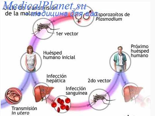 микроспоридиоз