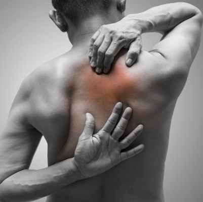 Миофасциальный синдром