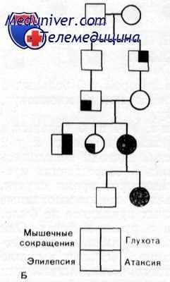 эпилепсия с атаксией