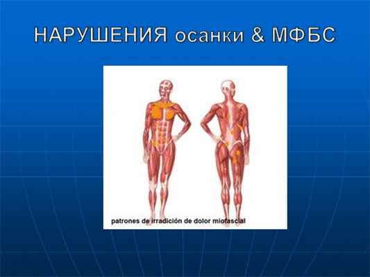 НАРУШЕНИЯ осанки & МФБС