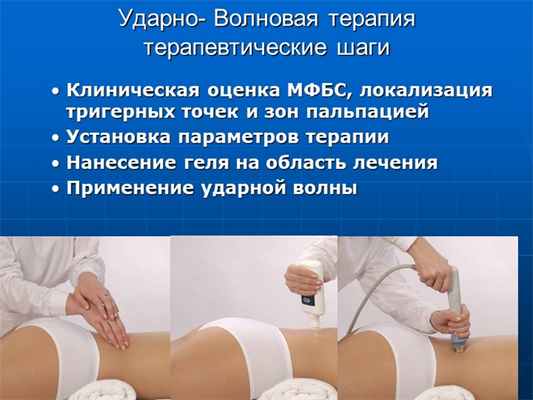Shockwave Therapy in musculoskeletal disorders treatment/ Ondrej Prouza31Удар. 
