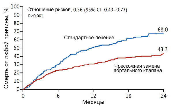 Транскатетерная замена аортального клапана при неоперабельном тяжелом аортальном стенозе