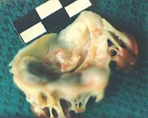 Митральный клапан