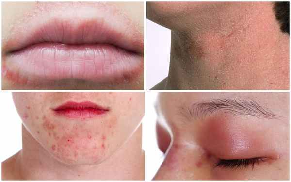 Шагаева (Саидова) Бурлият Солтанпашаевна, лор - Екатеринбург