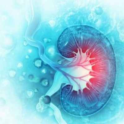 Камни в мочеточнике